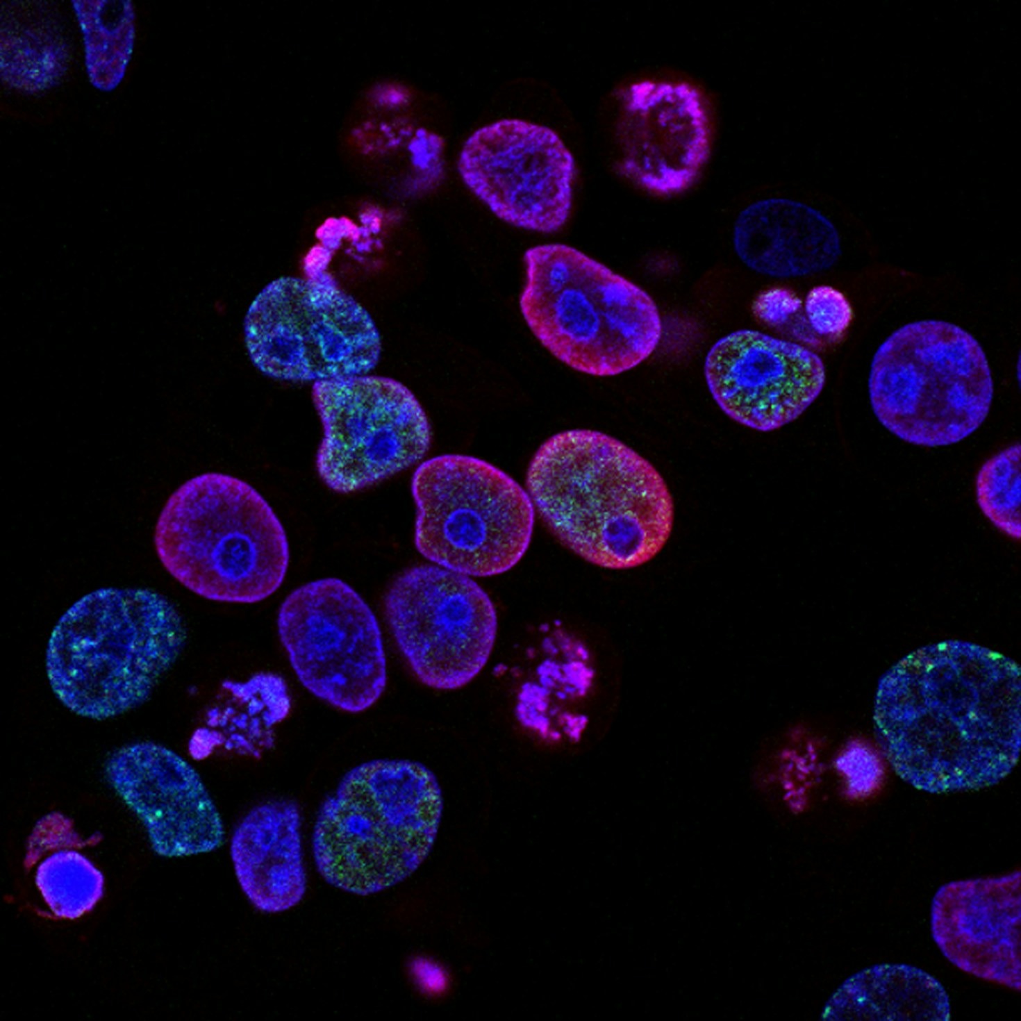 A Future Without Genetic Diseases: The Vision of BionicBiologics